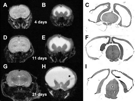 Comparison of rat brain morphology by MRI and histology at 4, 11 and 21 ...