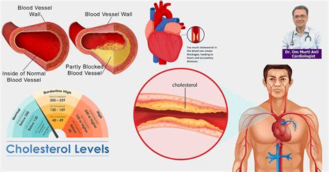 High cholesterol and triglycerides Risk and ways to Control | Collegenp