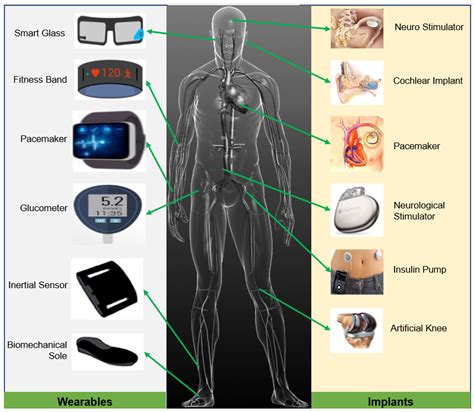 Implantable Medical Devices