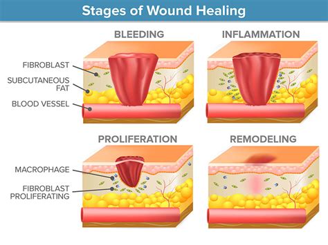 Wound Healing & OCT - Wasatch Photonics