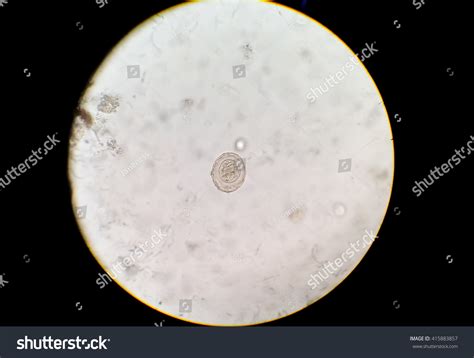 Hymenolepis Diminuta Egg Stool Under Microscope Stock Photo 415883857 ...