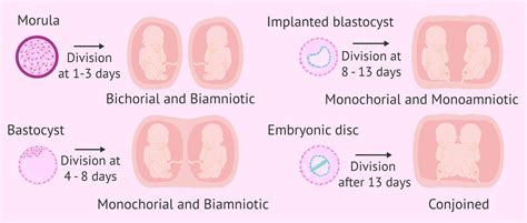 Stages Of Pregnancy With Triplets