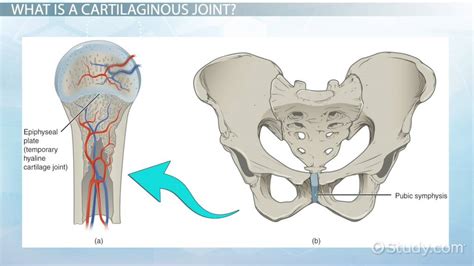 Cartilaginous Joint | Structure, Function & Examples - Lesson | Study.com