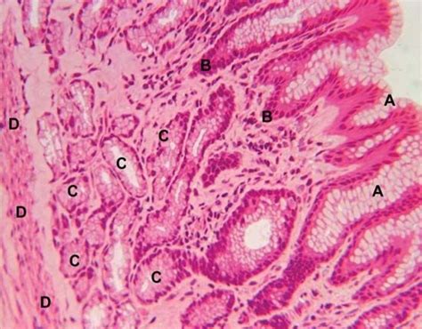 Mucoid cell | anatomy | Britannica.com