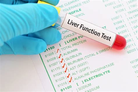 Liver function testing - myDr.com.au