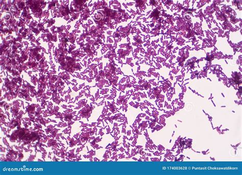 bacillus gram positive stain under microscope view. bacillus is rod-d ...