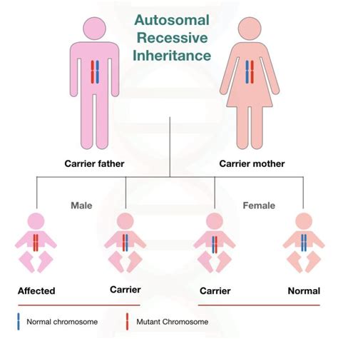 Sickle Cell Anaemia: Definition, Cause, Genetics, Trait, Symptoms and ...