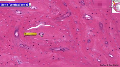 Histology of Bone (cortical bone) : Shotgun Histology - YouTube