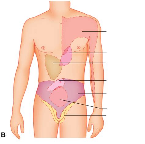 Referred Pain Diagram Diagram | Quizlet