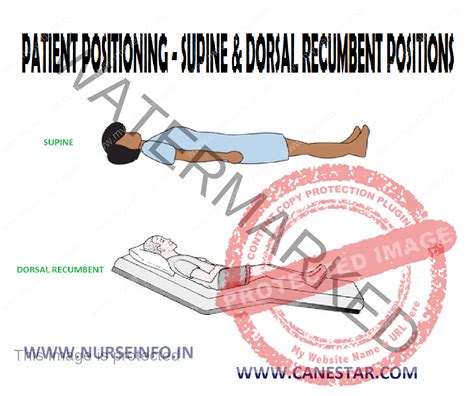 PATIENT POSITIONING – SUPINE & DORSAL RECUMBENT POSITION - Nurse Info