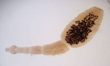 Echinococcus granulosus: Morphology, Life Cycle and Pathogenesis ...