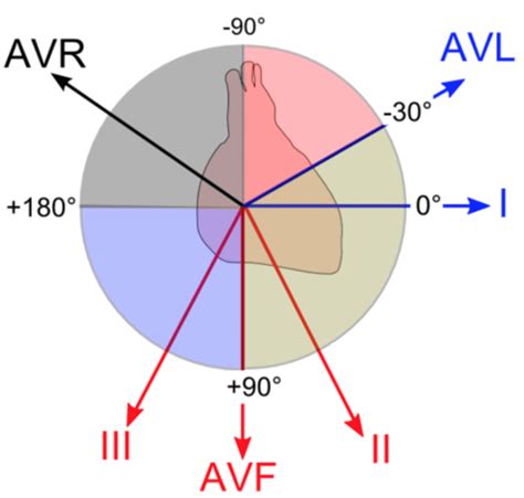 ECG Basics - R.E.B.E.L. EM - Emergency Medicine Blog