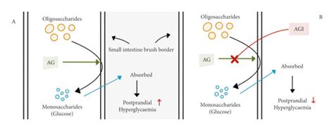 Mechanism of action of α-glucosidase inhibitors. A: absence of ...