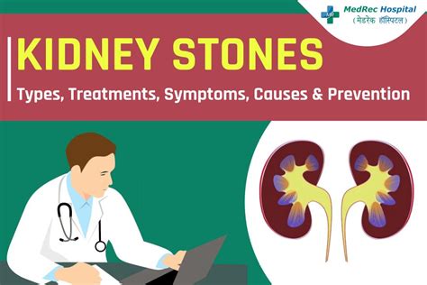 Kidney Stones Explained: Types, Treatments, Symptoms, Causes