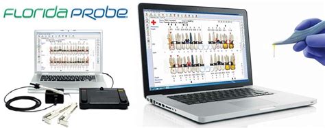 The Florida Probe | Ultrasmile