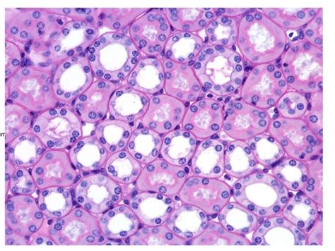 Histology of Renal Tubule & Collecting Duct Diagram | Quizlet