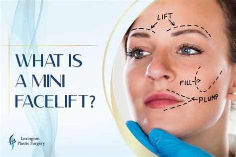 Mini Facelift Procedure: What It Is And How It Works [2023]