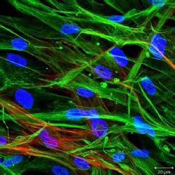 Fibroblast Cell Markers | Research Areas: Novus Biologicals