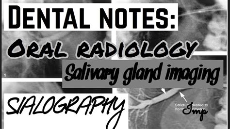 SIALOGRAPHY || SALIVARY GLAND IMAGING || ORAL RADIOLOGY || DENTAL NOTES ...