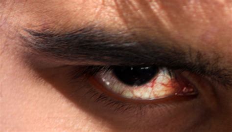 Anger expressed through an eye - PixaHive