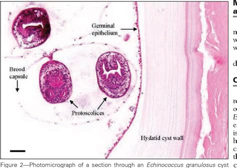 Figure 2 from Pathology in practice. Echinococcosis (hydatidosis) in a ...