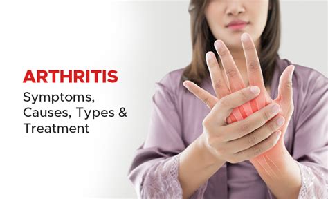 Arthritis: Symptoms, Causes, Types & Treatment - PSRI Hospital