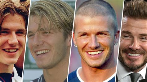 David Beckham's smile makeover: before and after photos