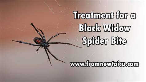 Black Widow Spider Bite Symptoms Humans - Widow Spider Bite Symptoms ...