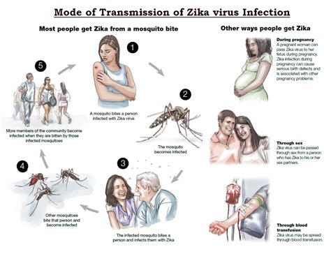 Zika virus Infection: Causes, Sign & Symptoms, Mode of Transmission ...