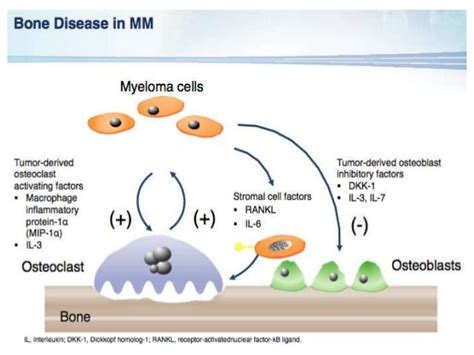 Plasma Cell Disorders