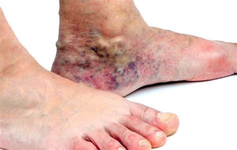 What Causes Skin Discoloration? | USA Vein Clinics