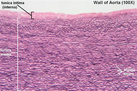 Blood Vessels – Tutorial – Histology Atlas for Anatomy and Physiology