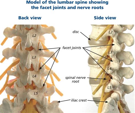 Lumbar facet syndrome causes, symptoms, diagnosis, treatment & prognosis