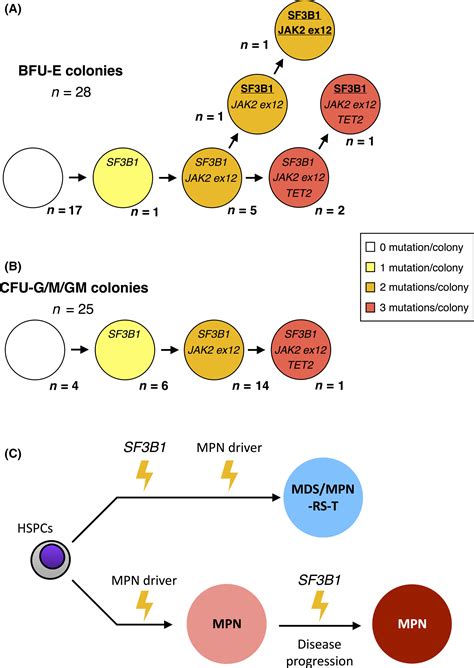 JAK2 exon 12 mutation in myelodysplastic/myeloproliferative neoplasm ...