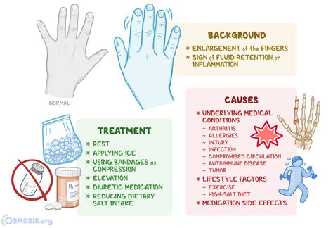 Swollen Fingers: What Are They, Causes, Treatment | Osmosis