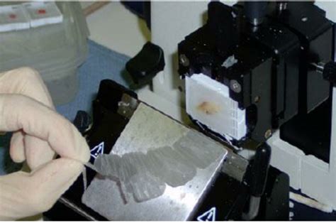 Tissue block is sectioned with microtome fitted with a sharp knife. The ...