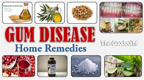 Home Remedies for Gum Disease | TheGoodPoint - The Good Point