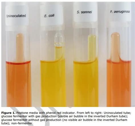 Carbohydrate Fermentation Test: Uses, Principle, Procedure and Results ...