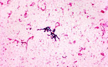 Streptococcus intermedius