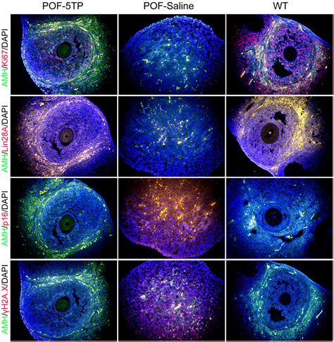 Immunofluorescence staining results of markers of cellular ...