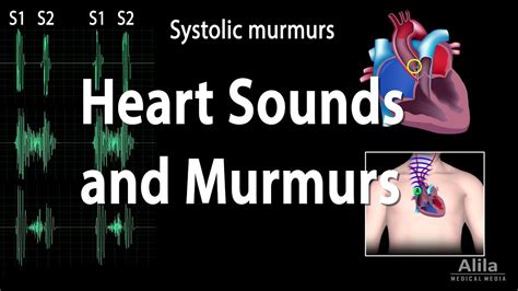 Heart Sounds and Heart Murmurs, Animation. - YouTube