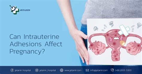 Can Intrauterine Adhesions Affect Pregnancy? | Jetanin