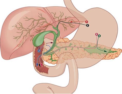 Endosonography-guided cholangiopancreatography as a salvage drainage ...