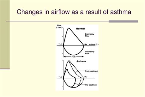 PPT - Spirometry For the Diagnosis of COPD and Asthma PowerPoint ...