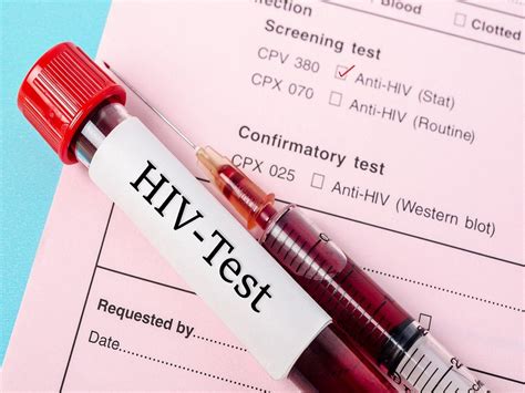 HIV infection | What are the current testing methods for HIV/AIDS? Know ...