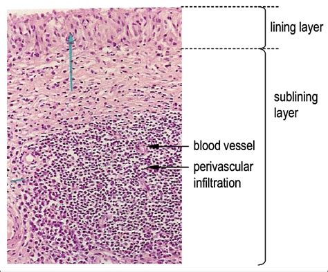 Membrane Histology