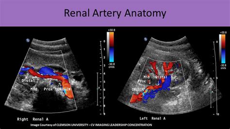 Inferior Mesenteric Artery Ultrasound