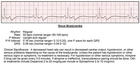 Bradycardia ECG - ACLS Wiki