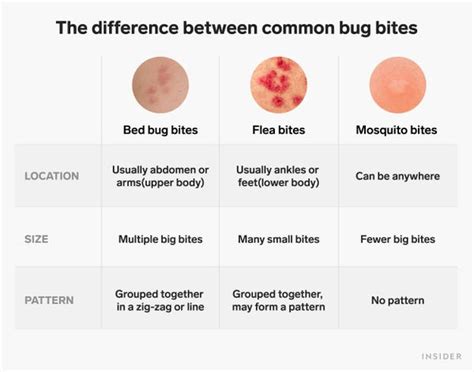 Chigger Bites Vs Bed Bug Bites