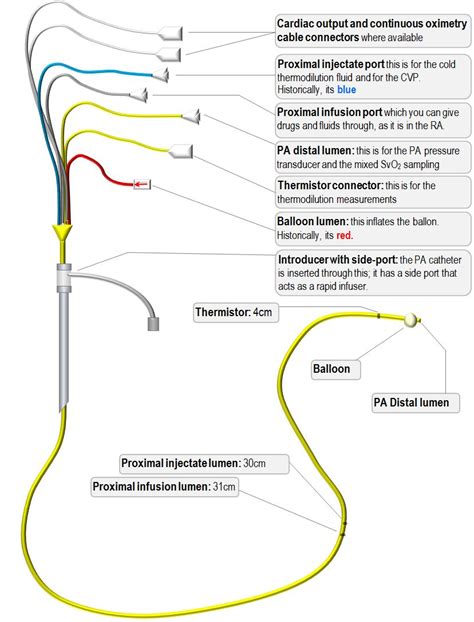 [DIAGRAM] Epidural Catheter Diagram - MYDIAGRAM.ONLINE